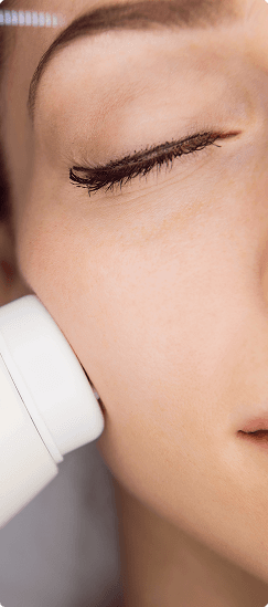 LASER REJUVENATION